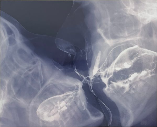 Wim Delvoye, Kiss 5